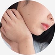 목과 어깨에 점과 검버섯이 보이는 피부 근접 사진